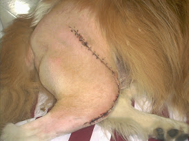 ACL surgery