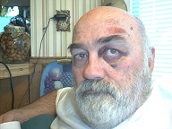 Arthur Fall Down Go Boom